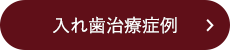 入れ歯治療症例