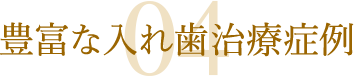 豊富な入れ歯治療症例