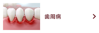歯周病