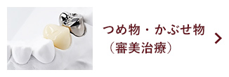 つめ物・かぶせ物（審美治療）