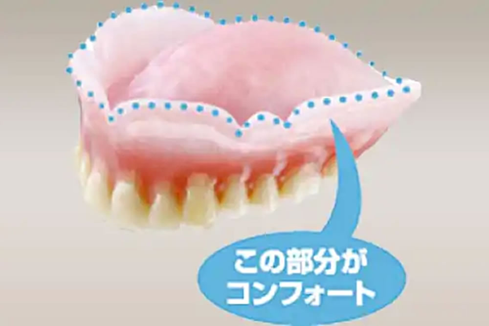 コンフォートデンチャー