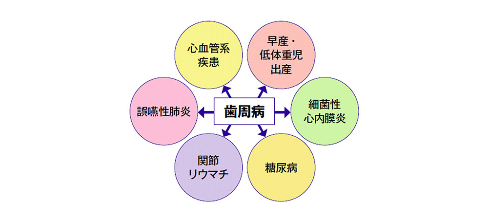 歯周病と全身疾患のリスク