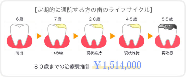 予防する人・しない人の治療費と歯の寿命