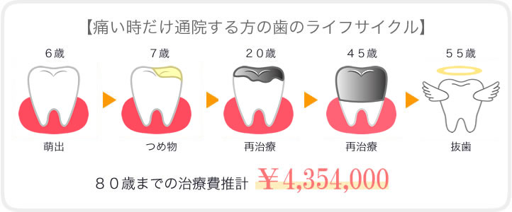 予防する人・しない人の治療費と歯の寿命